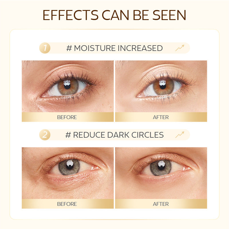 Gold Snail Eye Mask 50 Pieces Moisturizing And Hydrating